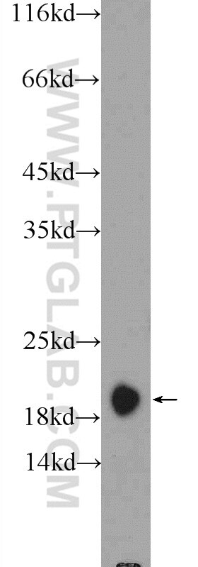 Centrin 2 Polyclonal antibody