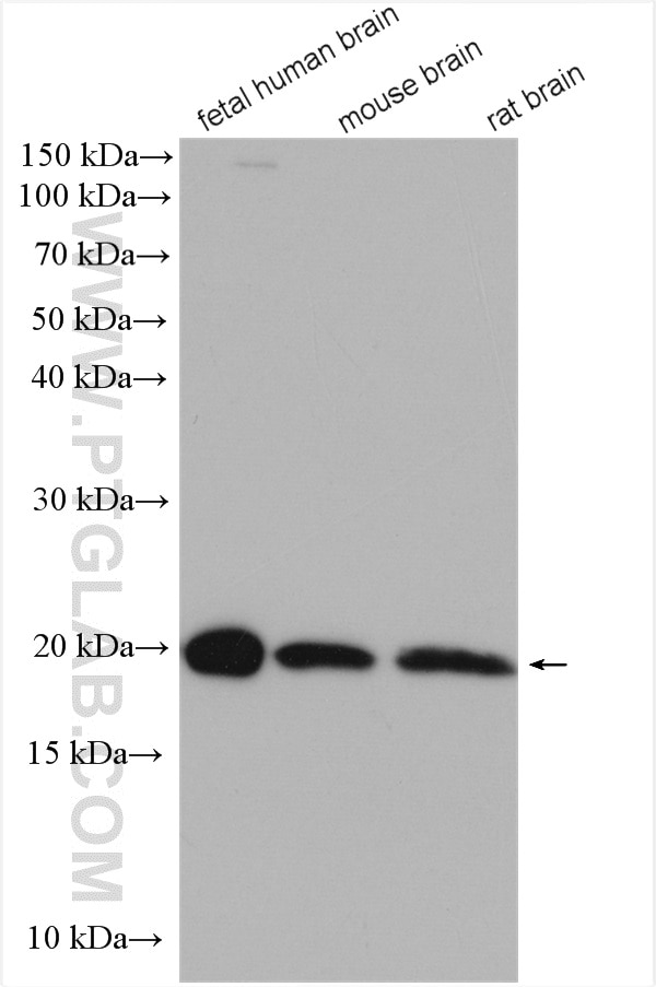 Western Blot (WB) analysis of various lysates using Centrin 2 Polyclonal antibody (15877-1-AP)