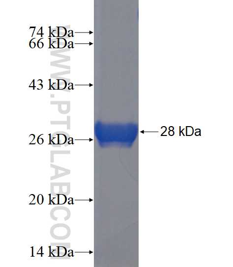 CETN2 fusion protein Ag23253 SDS-PAGE
