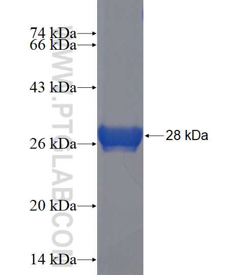 CETN2 fusion protein Ag23253 SDS-PAGE CETN2 fusion protein Ag23253 SDS-PAGE