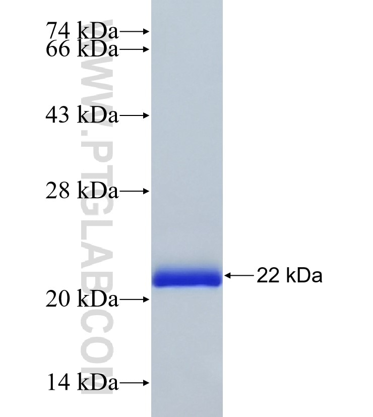 Centrin 2 fusion protein Ag8567 SDS-PAGE