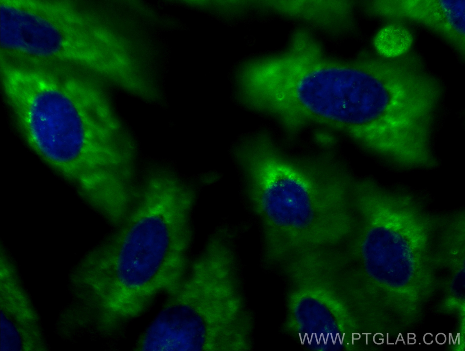 Immunofluorescence (IF) / fluorescent staining of A549 cells using Centrin 3 Polyclonal antibody (15811-1-AP)