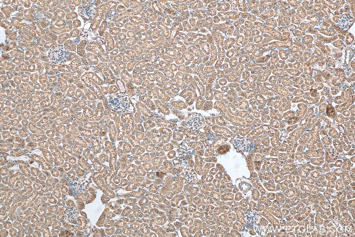 Immunohistochemistry (IHC) staining of mouse kidney tissue using Centrin 3 Polyclonal antibody (15811-1-AP)