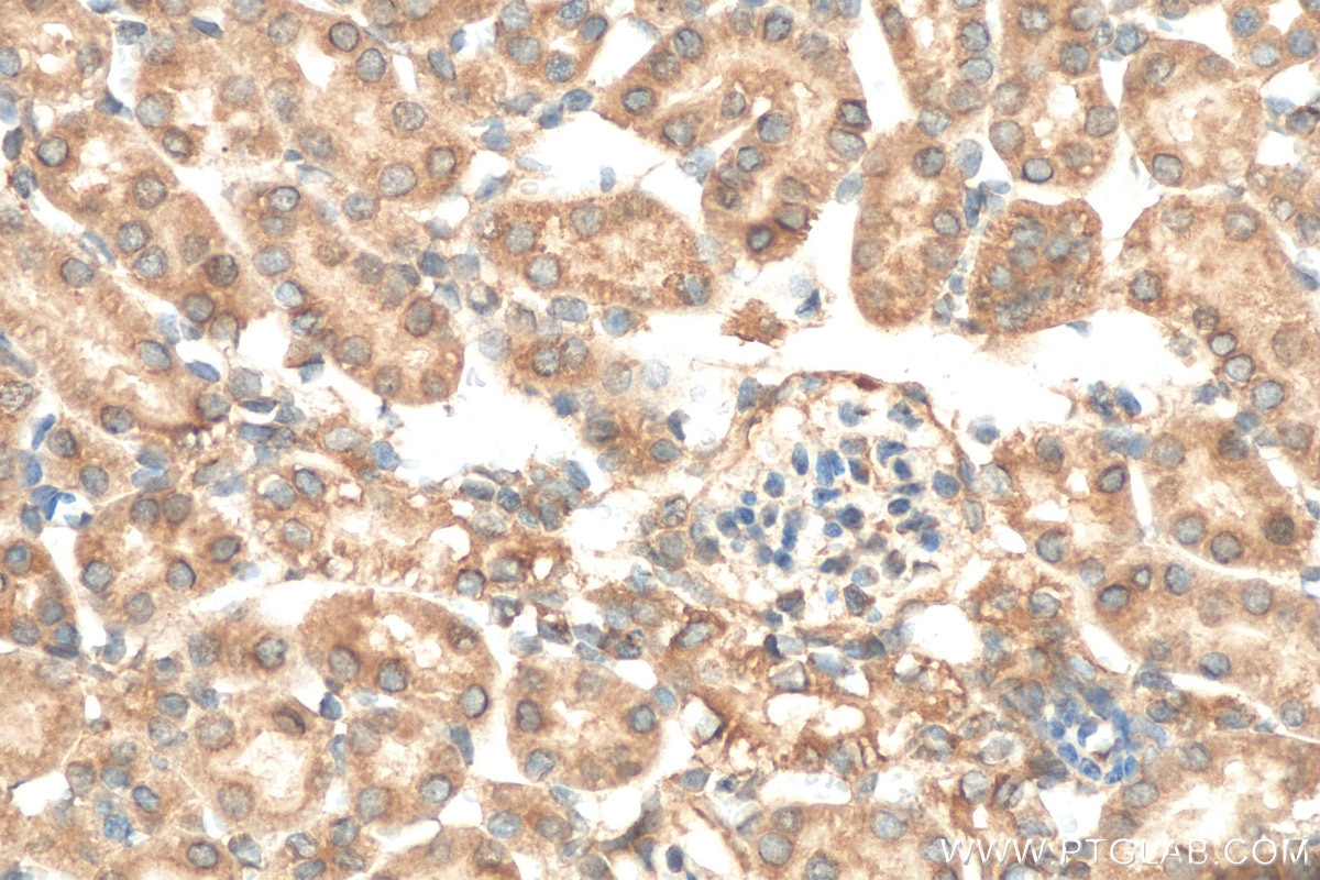 Immunohistochemistry (IHC) staining of mouse kidney tissue using Centrin 3 Polyclonal antibody (15811-1-AP)