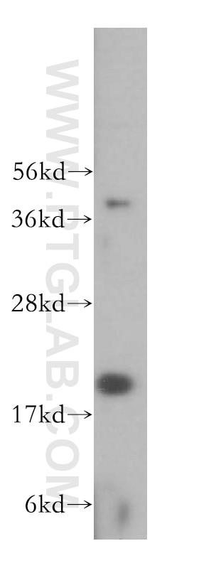 Centrin 3 Polyclonal antibody