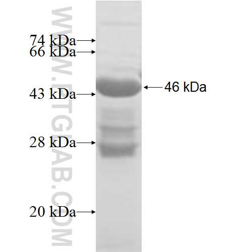 CETN3 fusion protein Ag8547 SDS-PAGE