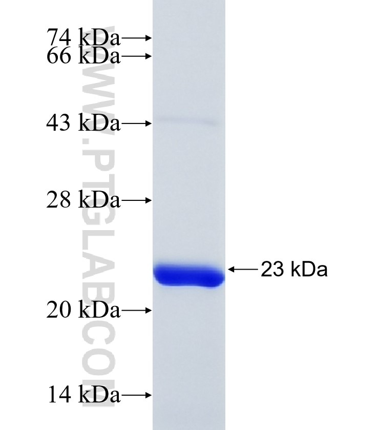 CETN3 fusion protein Ag8844 SDS-PAGE