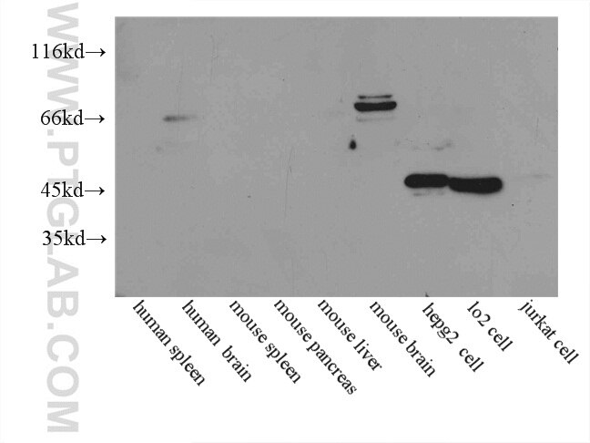 CETP Polyclonal antibody