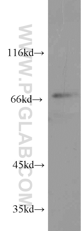 Western Blot (WB) analysis of human brain tissue using CETP Polyclonal antibody (13459-1-AP)