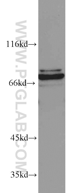 CETP Polyclonal antibody