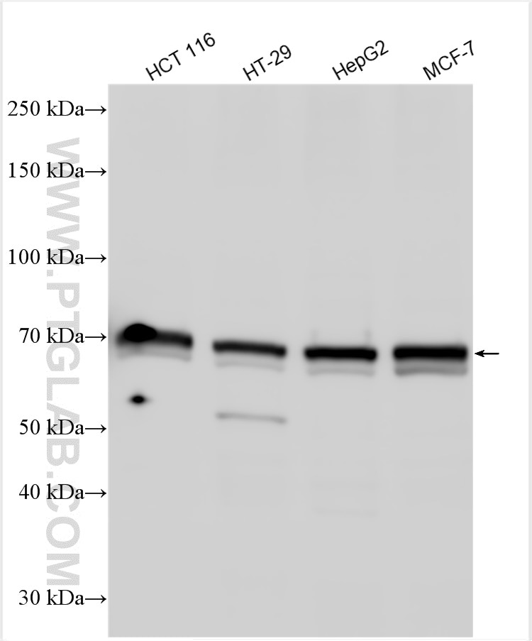 Western Blot (WB) analysis of various lysates using CETP Polyclonal antibody (30136-1-AP)