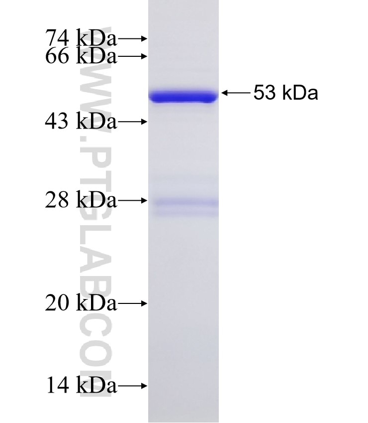 CETP fusion protein Ag32722 SDS-PAGE