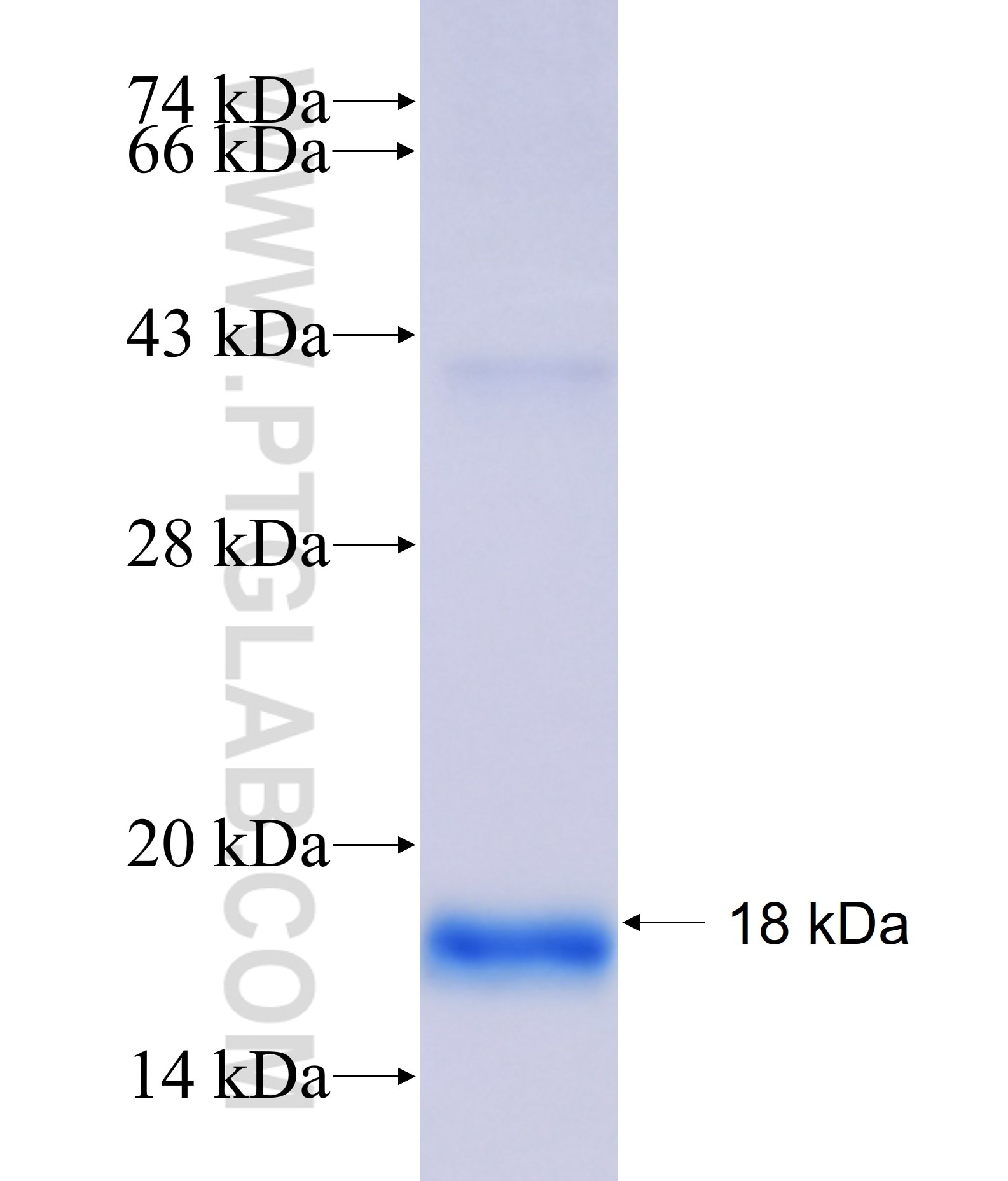 CFAP141 fusion protein Ag37822 SDS-PAGE