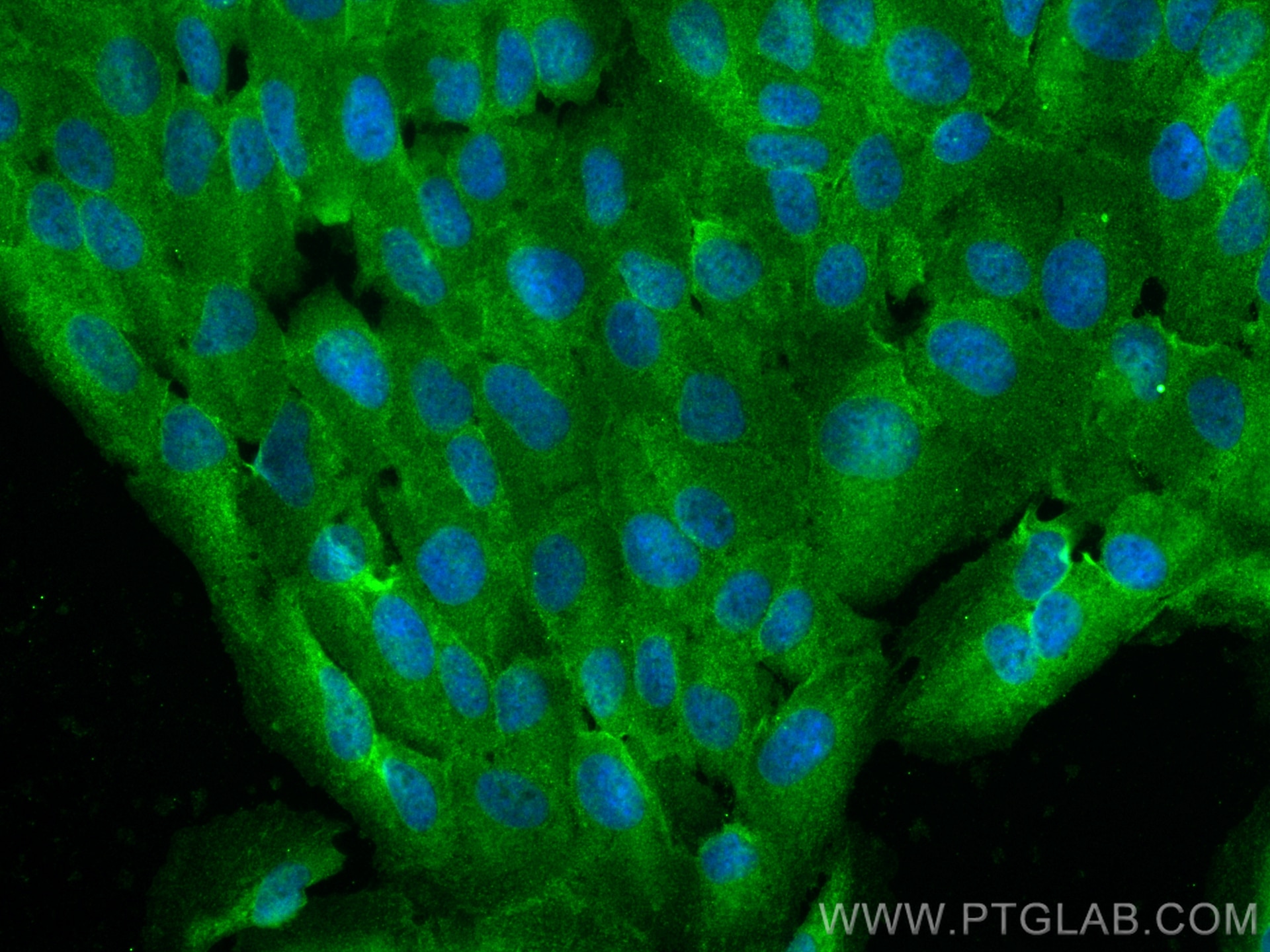 IF Staining of hTERT-RPE1 using 30579-1-AP Immunofluorescence (IF) / fluorescent staining of hTERT-RPE1 cells using CFAP47 Polyclonal antibody (30579-1-AP)