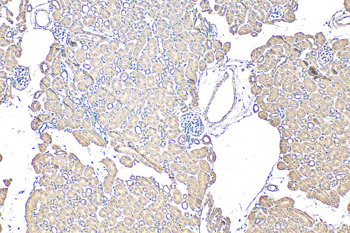 IHC staining of mouse kidney using 30579-1-AP Immunohistochemistry (IHC) staining of mouse kidney tissue using CFAP47 Polyclonal antibody (30579-1-AP)