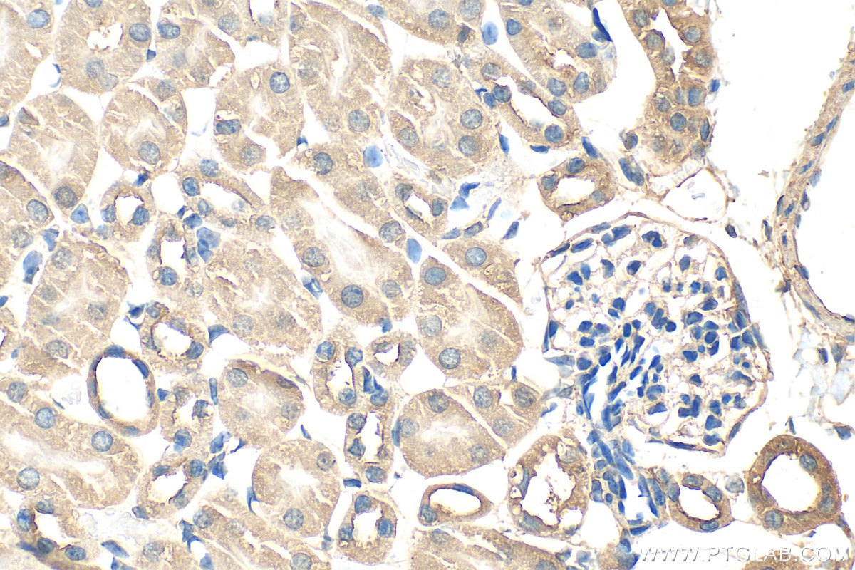 IHC staining of mouse kidney using 30579-1-AP Immunohistochemistry (IHC) staining of mouse kidney tissue using CFAP47 Polyclonal antibody (30579-1-AP)