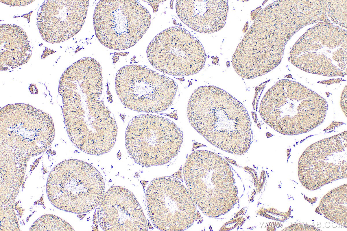IHC staining of mouse testis using 30579-1-AP Immunohistochemistry (IHC) staining of mouse testis tissue using CFAP47 Polyclonal antibody (30579-1-AP)