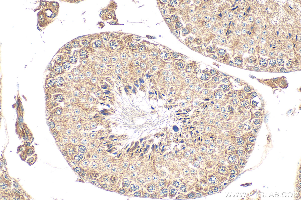 IHC staining of mouse testis using 30579-1-AP Immunohistochemistry (IHC) staining of mouse testis tissue using CFAP47 Polyclonal antibody (30579-1-AP)