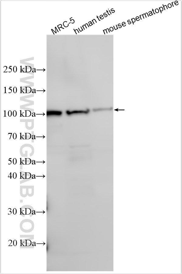 WB analysis using 30579-1-AP Western Blot (WB) analysis of various lysates using CFAP47 Polyclonal antibody (30579-1-AP)