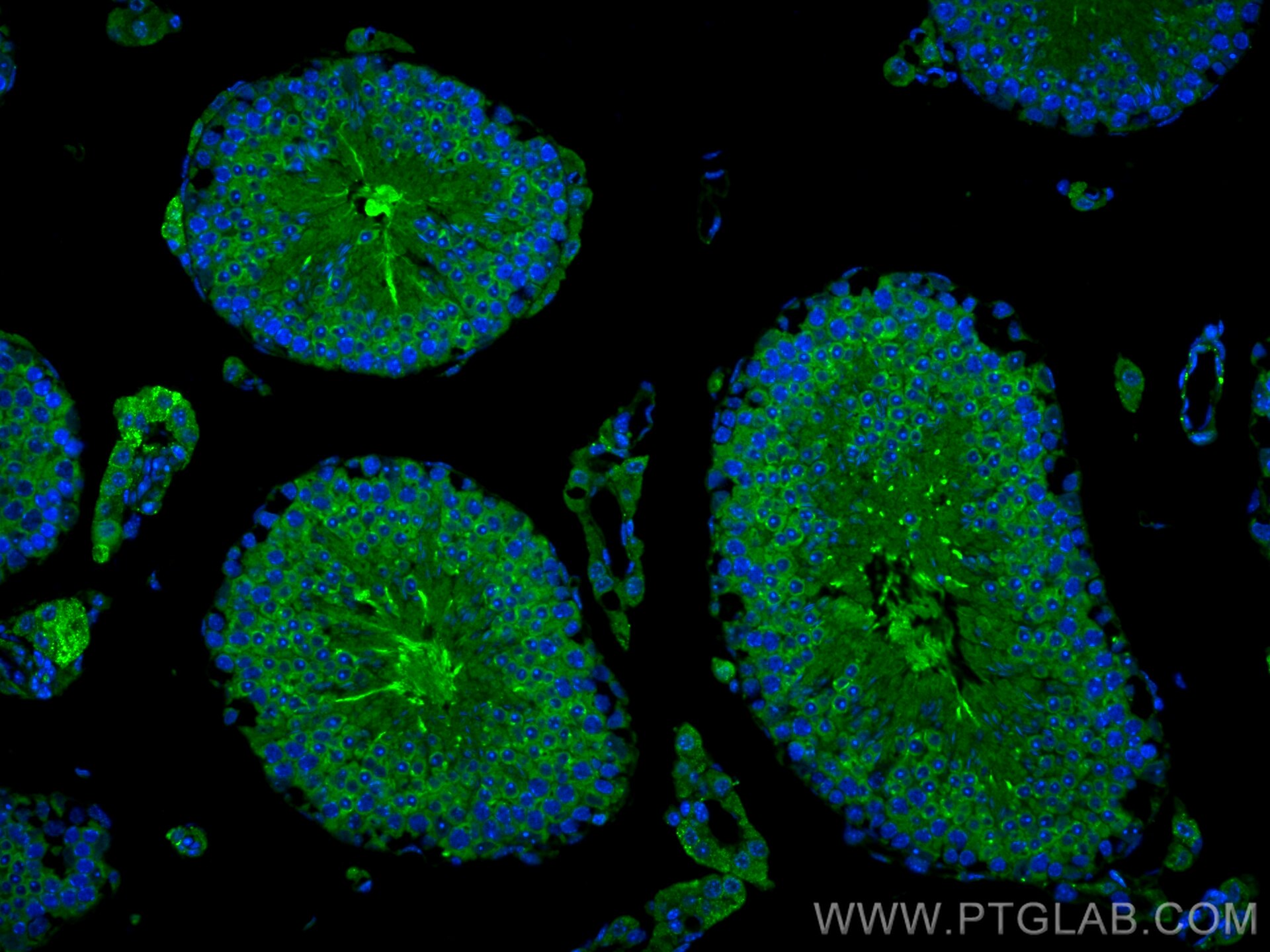 Immunofluorescence (IF) / fluorescent staining of mouse testis tissue using CFAP70 Polyclonal antibody (31344-1-AP)