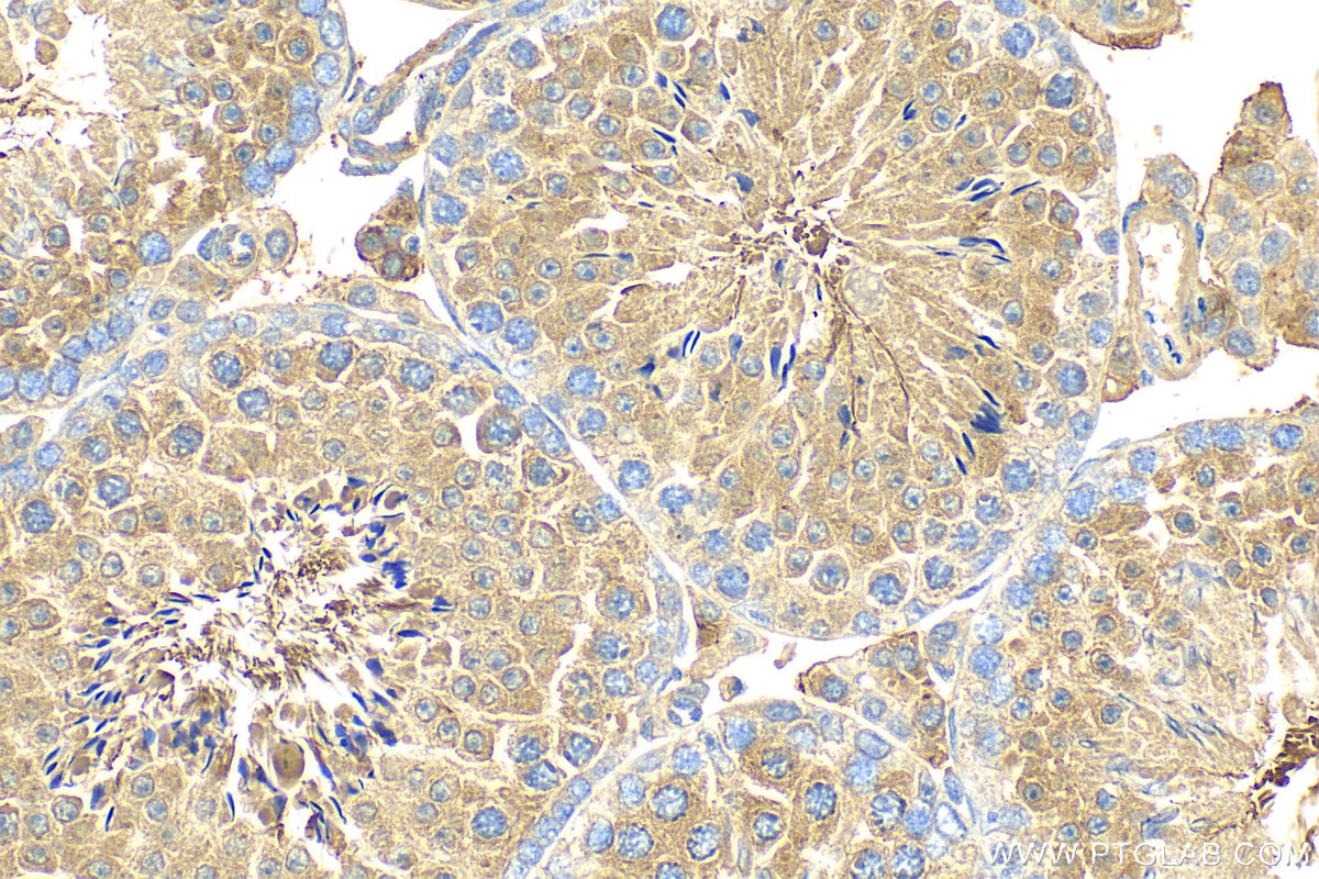 Immunohistochemistry (IHC) staining of mouse testis tissue using CFAP70 Polyclonal antibody (31344-1-AP)