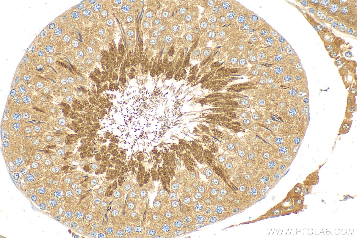 Immunohistochemistry (IHC) staining of rat testis tissue using CFAP70 Polyclonal antibody (31344-1-AP)