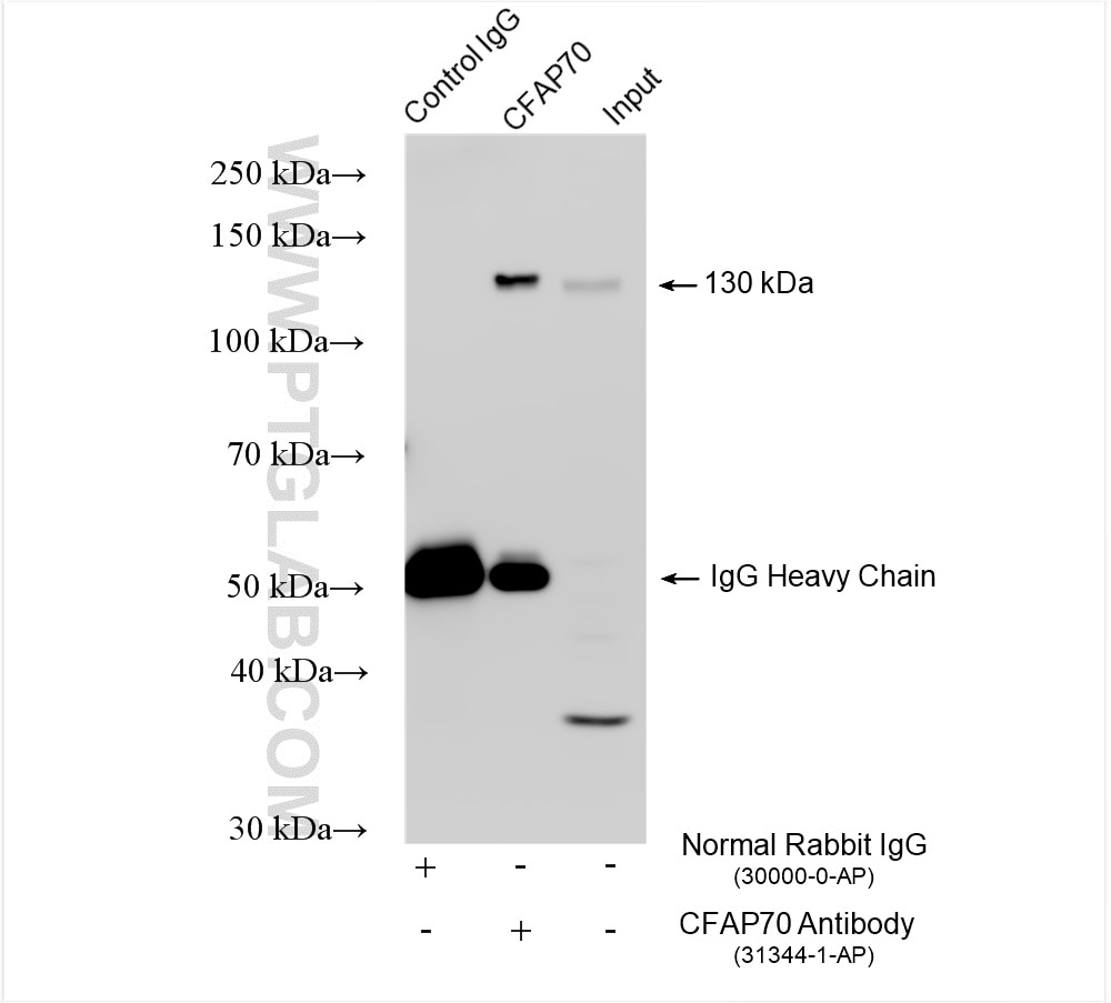 Immunoprecipitation (IP) experiment of mouse testis tissue using CFAP70 Polyclonal antibody (31344-1-AP)