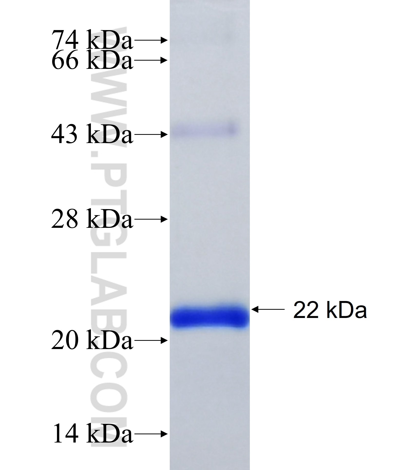 CFAP95 fusion protein Ag37963 SDS-PAGE CFAP95 fusion protein Ag37963 SDS-PAGE
