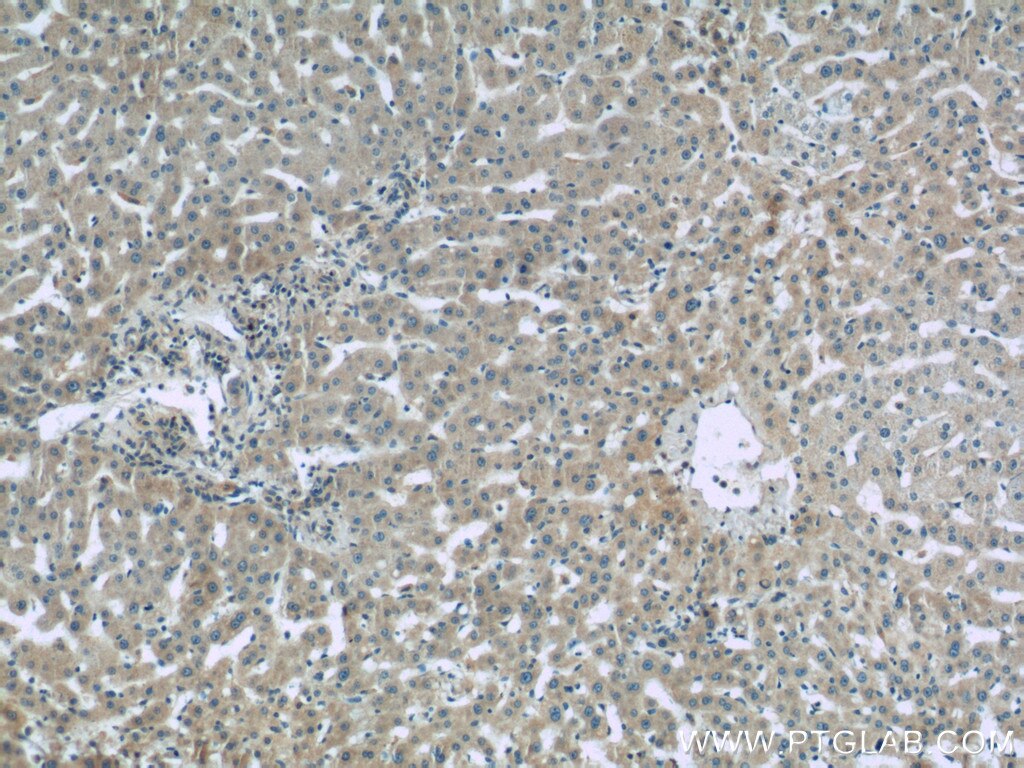Immunohistochemistry (IHC) staining of human liver tissue using Complement factor B Polyclonal antibody (10170-1-AP)