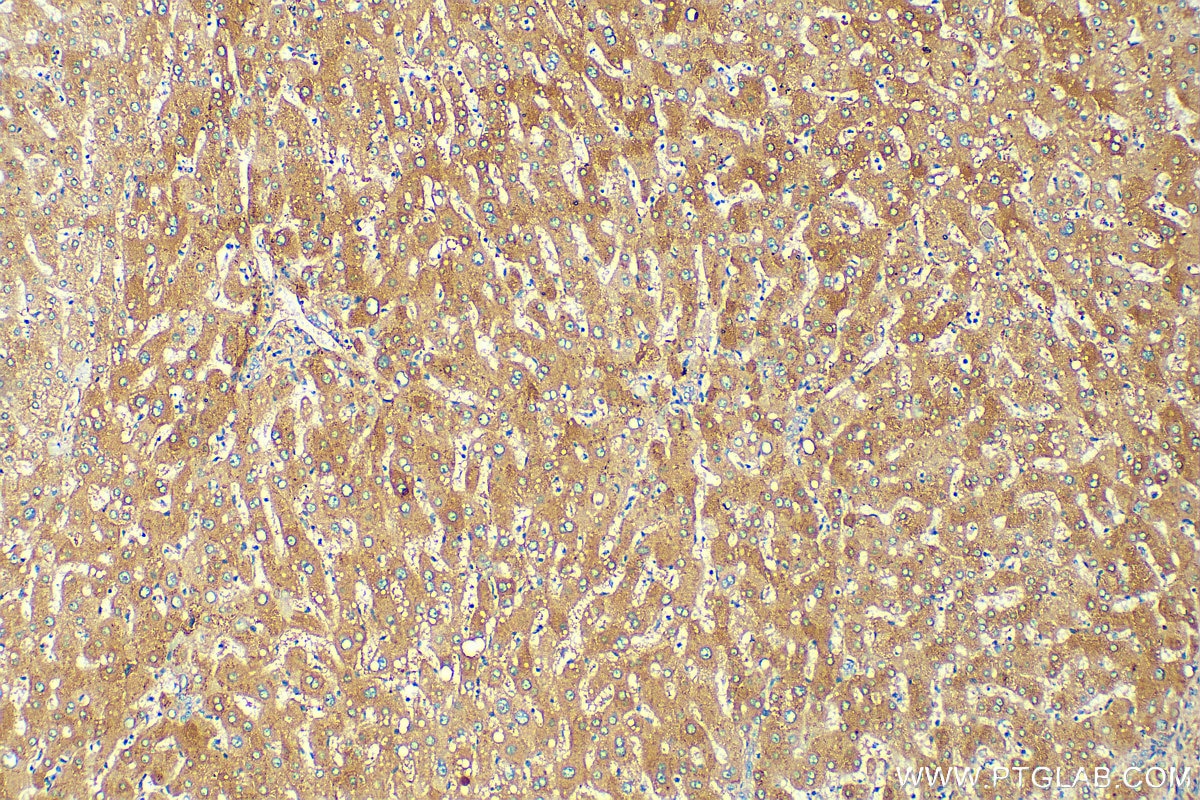 Immunohistochemistry (IHC) staining of human liver tissue using Complement factor B Polyclonal antibody (10170-1-AP)