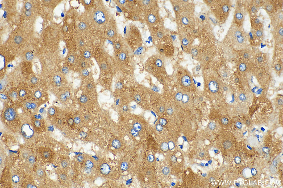 IHC staining of human liver using 10170-1-AP