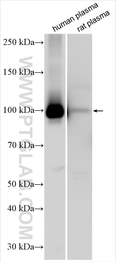 Western Blot (WB) analysis of various lysates using Complement factor B Polyclonal antibody (10170-1-AP)