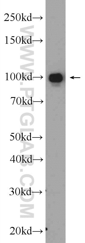 Western Blot (WB) analysis of human blood using Complement factor B Polyclonal antibody (10170-1-AP)