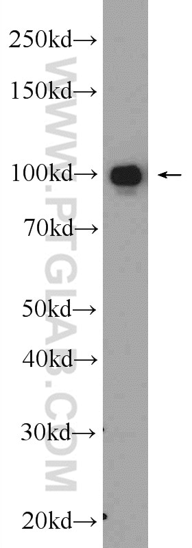 WB analysis of human blood using 10170-1-AP