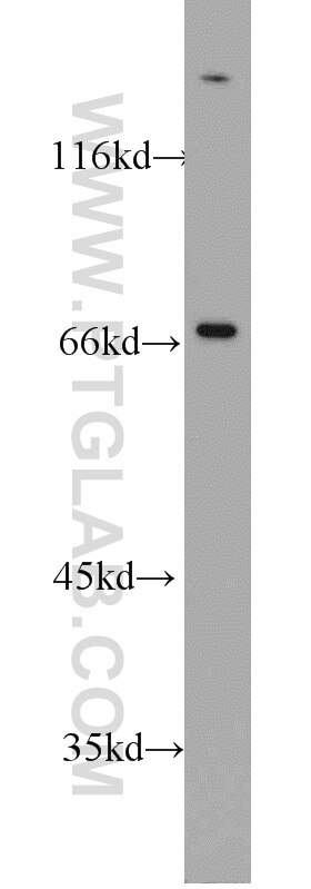 Complement factor B