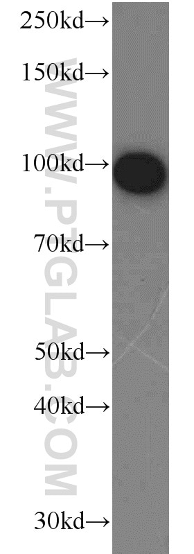 Complement factor B Polyclonal antibody