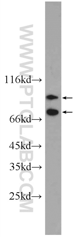 Western Blot (WB) analysis of human plasma using Complement factor B Polyclonal antibody (10170-1-AP)