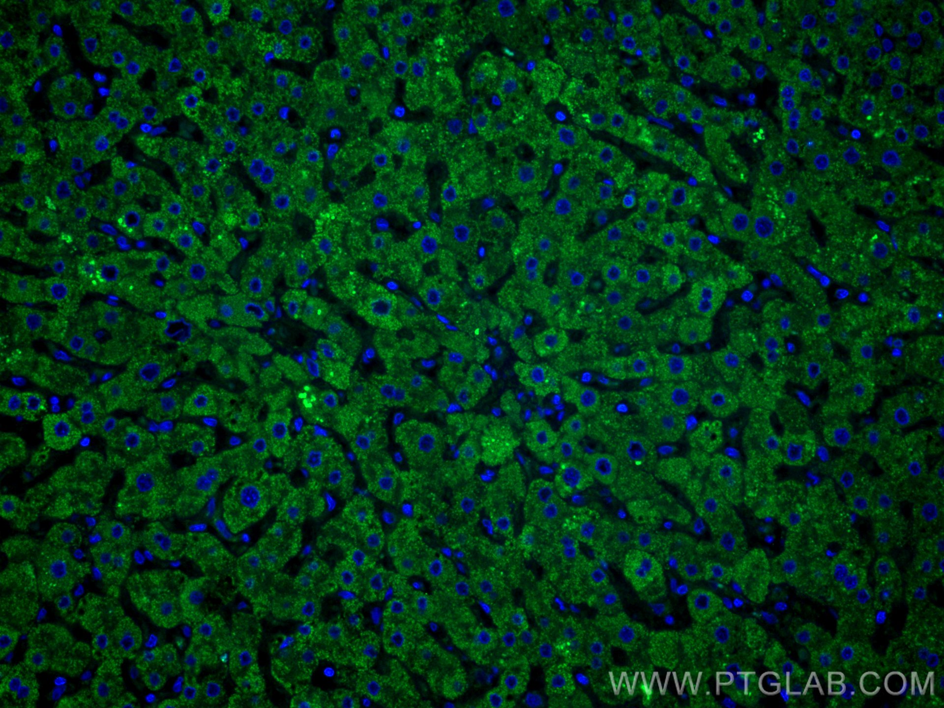 Immunofluorescence (IF) / fluorescent staining of human liver tissue using Complement factor B Monoclonal antibody (66154-1-Ig)