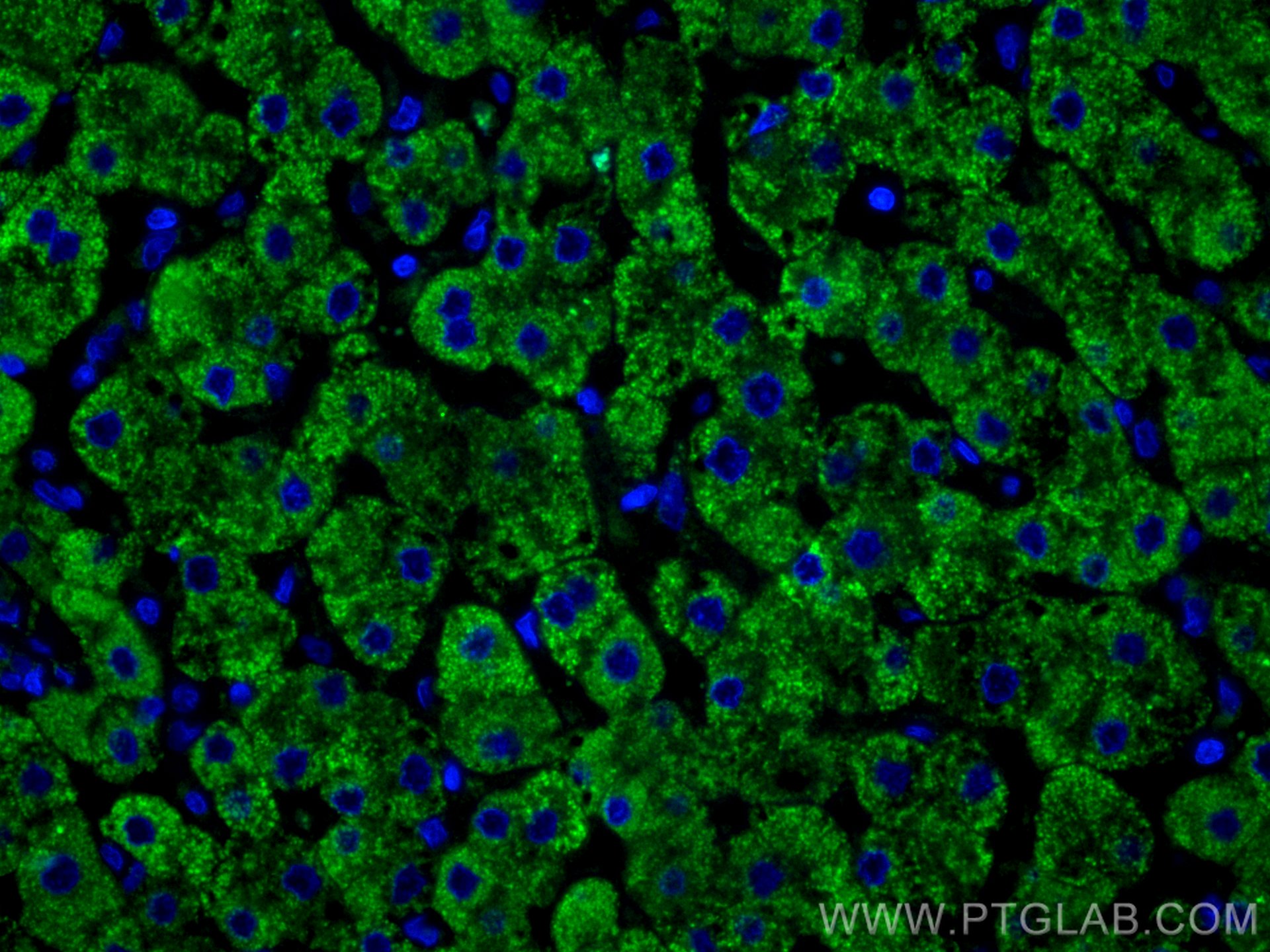 Immunofluorescence (IF) / fluorescent staining of human liver tissue using Complement factor B Monoclonal antibody (66154-1-Ig)