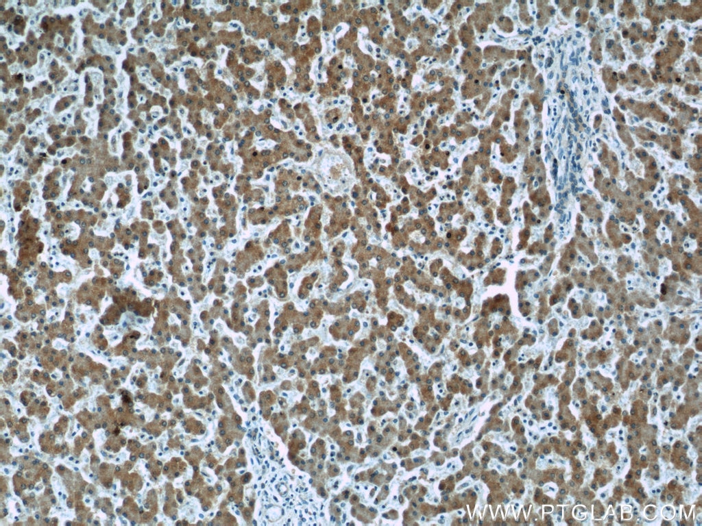 IHC staining of human liver using 66154-1-Ig