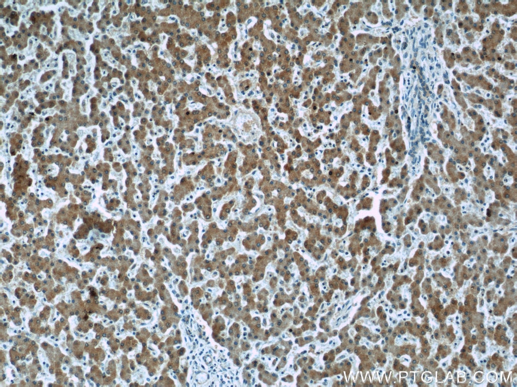 Immunohistochemistry (IHC) staining of human liver tissue using Complement factor B Monoclonal antibody (66154-1-Ig)