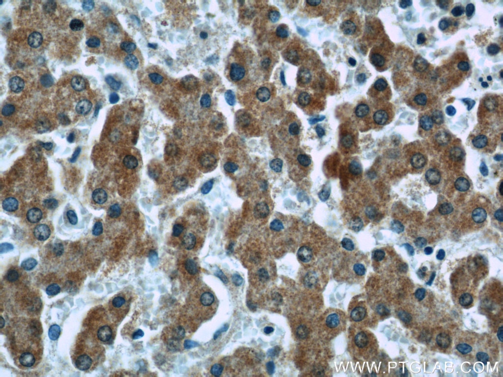 Immunohistochemistry (IHC) staining of human liver tissue using Complement factor B Monoclonal antibody (66154-1-Ig)