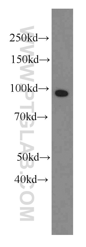 Western Blot (WB) analysis of human plasma using Complement factor B Monoclonal antibody (66154-1-Ig)