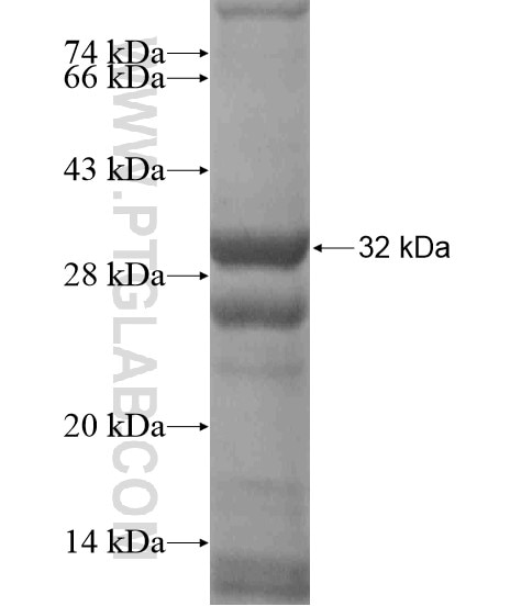 CFB fusion protein Ag19107 SDS-PAGE