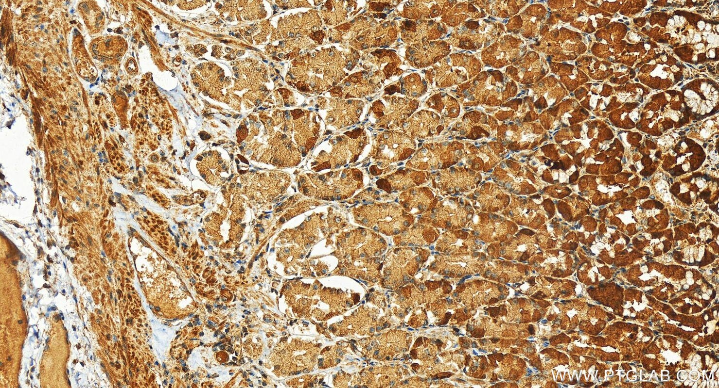 Immunohistochemistry (IHC) staining of human stomach tissue using Complement factor D Polyclonal antibody (26050-1-AP)
