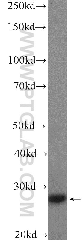 Western Blot (WB) analysis of human placenta tissue using CFD Polyclonal antibody (26050-1-AP)