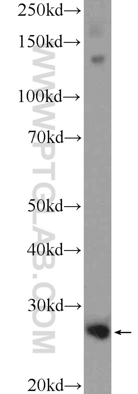 Western Blot (WB) analysis of human plasma using CFD Polyclonal antibody (26050-1-AP)