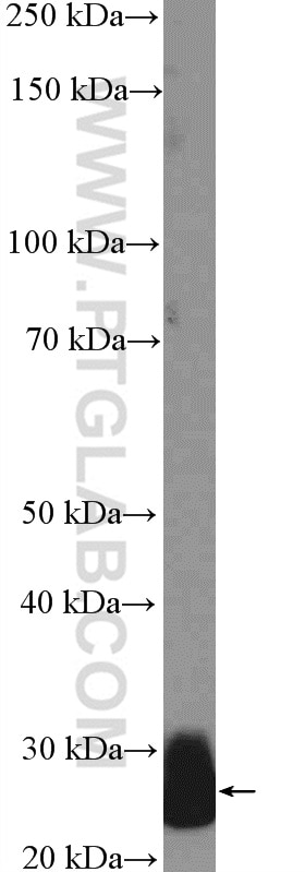 Western Blot (WB) analysis of human plasma using Complement factor D Polyclonal antibody (26050-1-AP)
