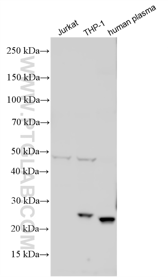 WB analysis using 26050-1-AP Western Blot (WB) analysis of various lysates using Complement factor D Polyclonal antibody (26050-1-AP)