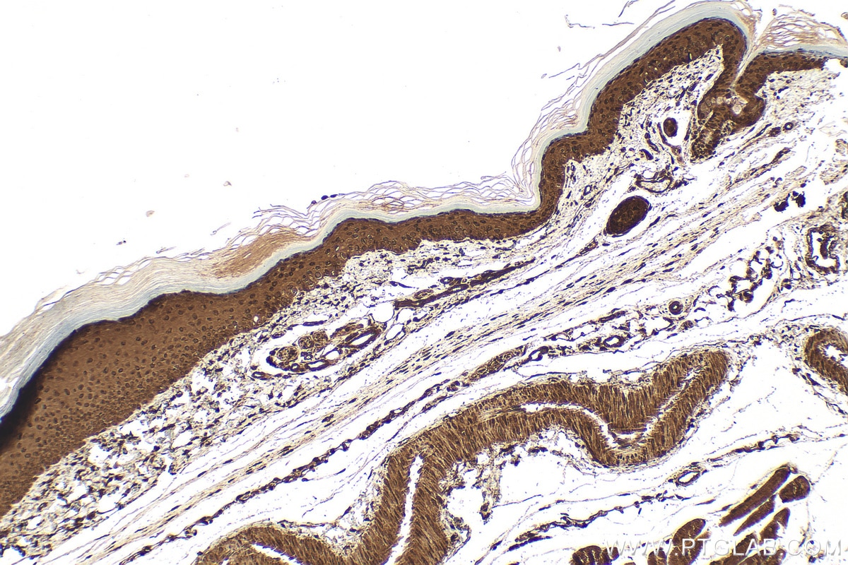 Immunohistochemistry (IHC) staining of mouse skin tissue using CFDP1 Polyclonal antibody (26636-1-AP)